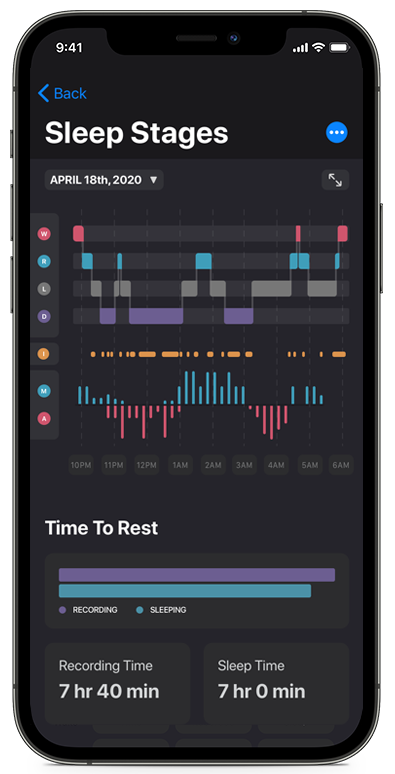 Iphone screenshot of a comprehensive sleep stages assessment
